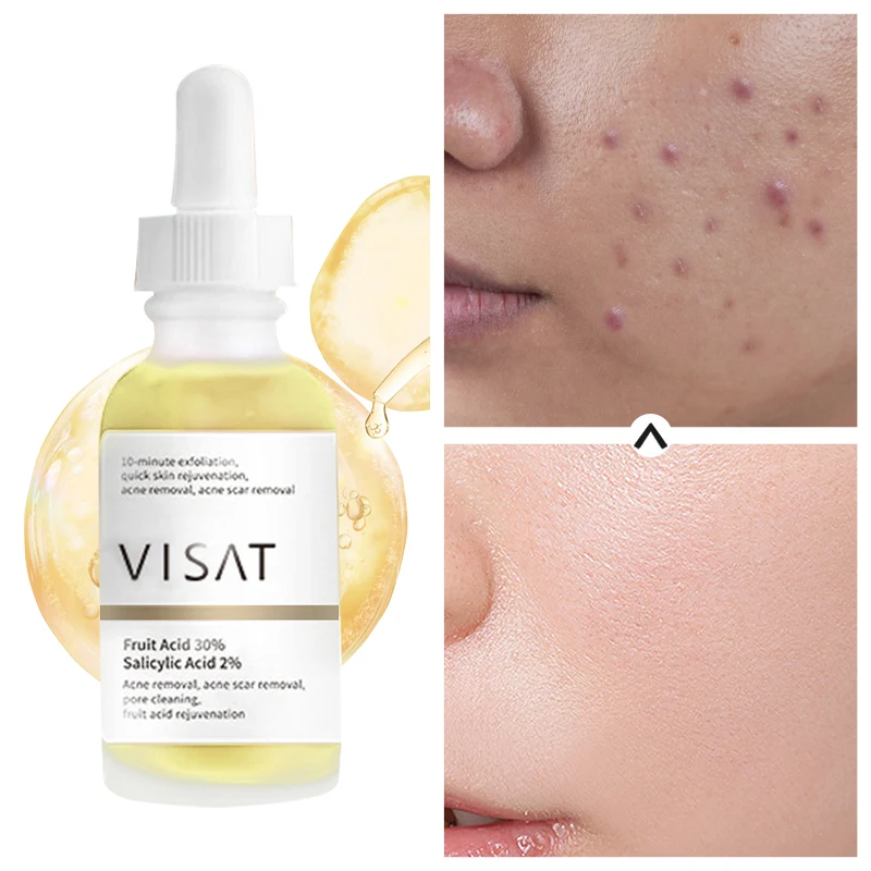 Korean Cosmetics Black Head Remover Beauty Face Skin Care Anti Acne Removal Essence Fruit Acid AHA Salicylic Serum Products