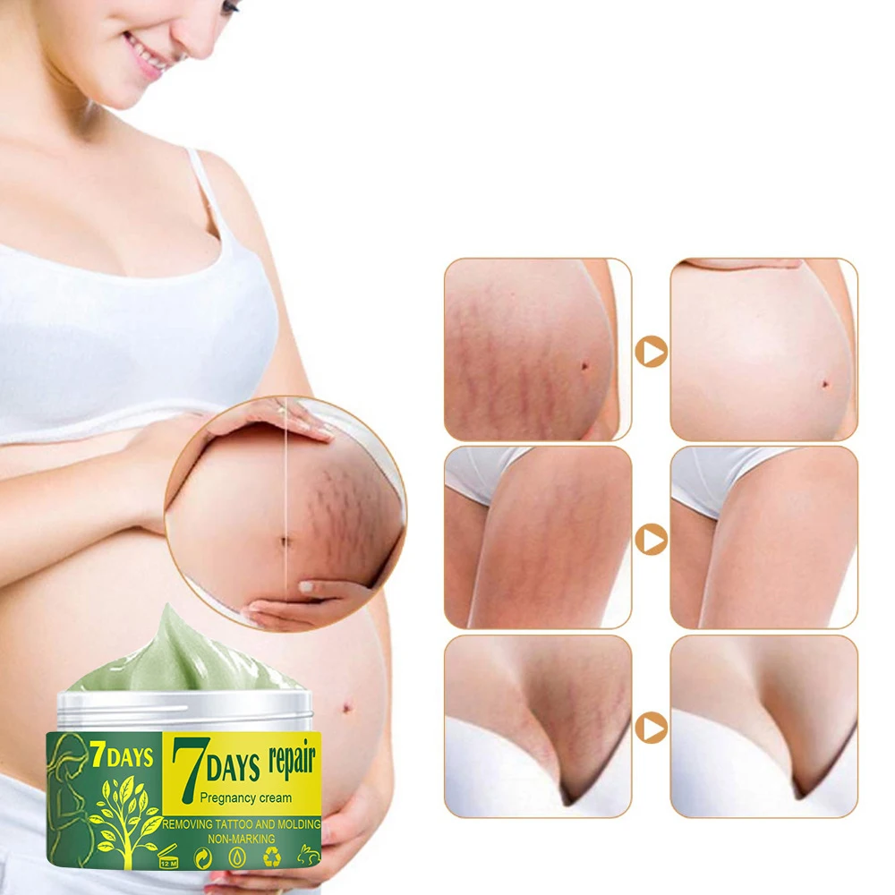 Good Effect Pregnancy Repairing stretch mark cream private label