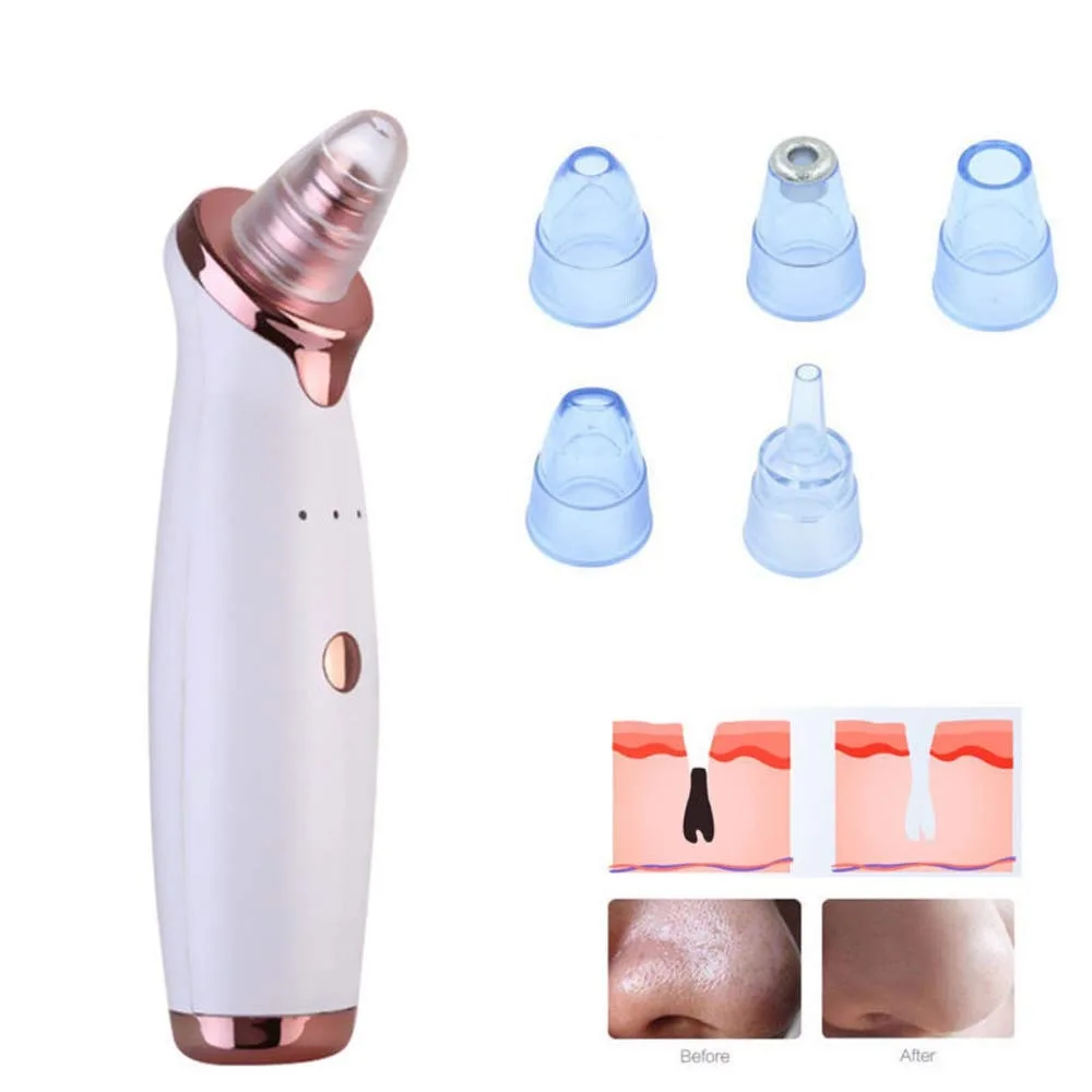 Vacuum Device Sucking Blackhead Vacuum BlackHead Remover