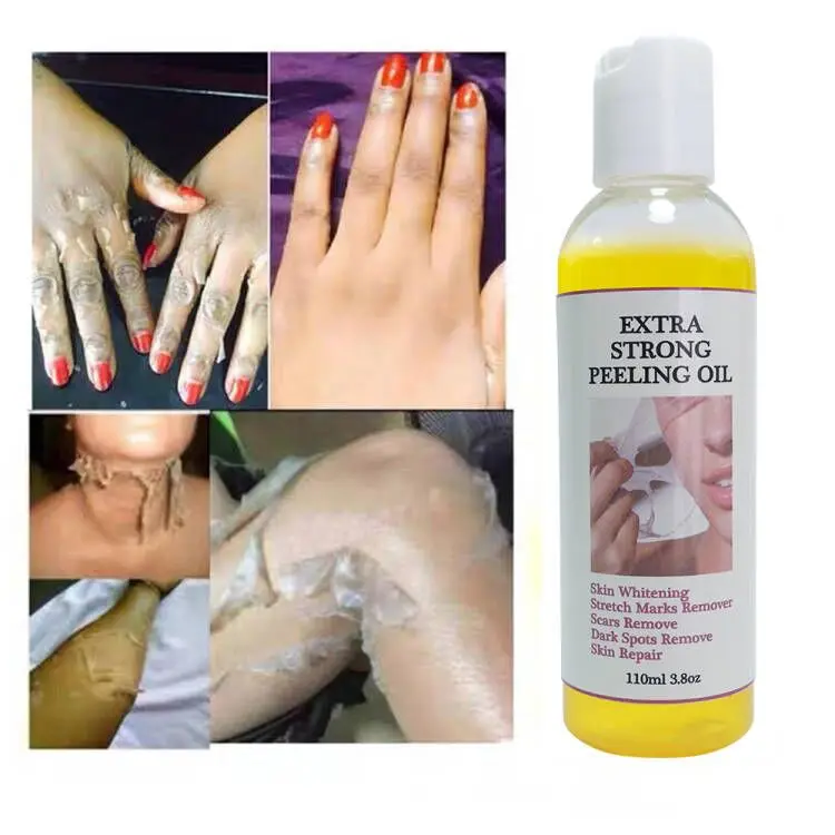 Private Label Skin Revitalizer Yellow Orange Peeling Oil For Face And Body