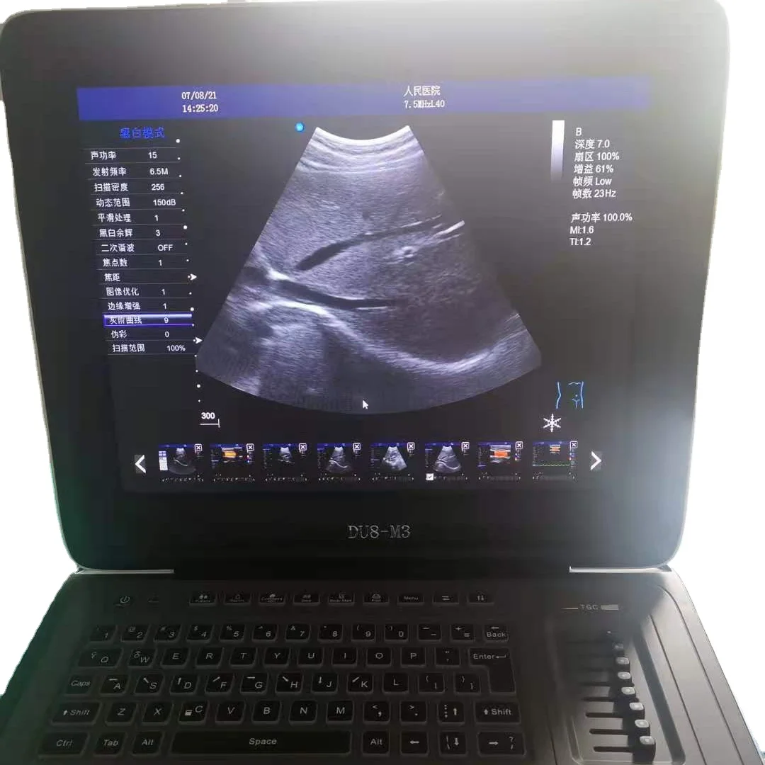 cheap price two active probe connectors convex linear  Color Doppler Ultrasound laptop transvaginal