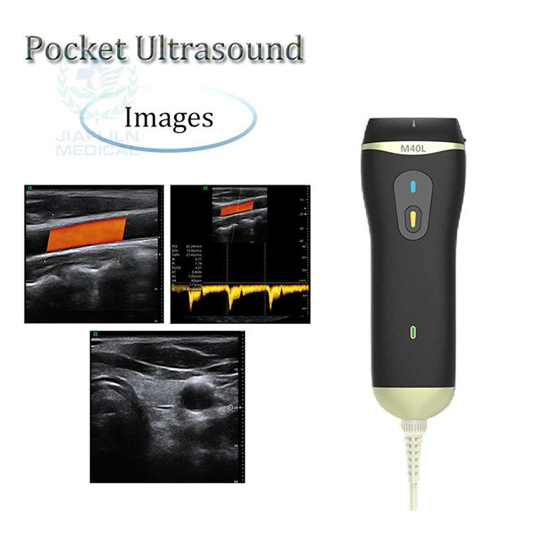 China Portable Ultrasound 128 Element Linear Vascular Probe iPhone Ultrasound Machine Doppler Vascular