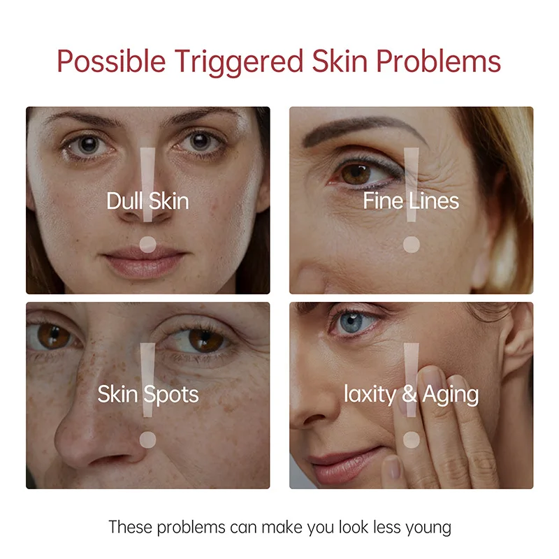 New JellyPrim Whitening Face Serum Anti Aging Acne Remove Dark Spots Shrink Pores Serum Skin Care Korean Cosmetics Beauty Health