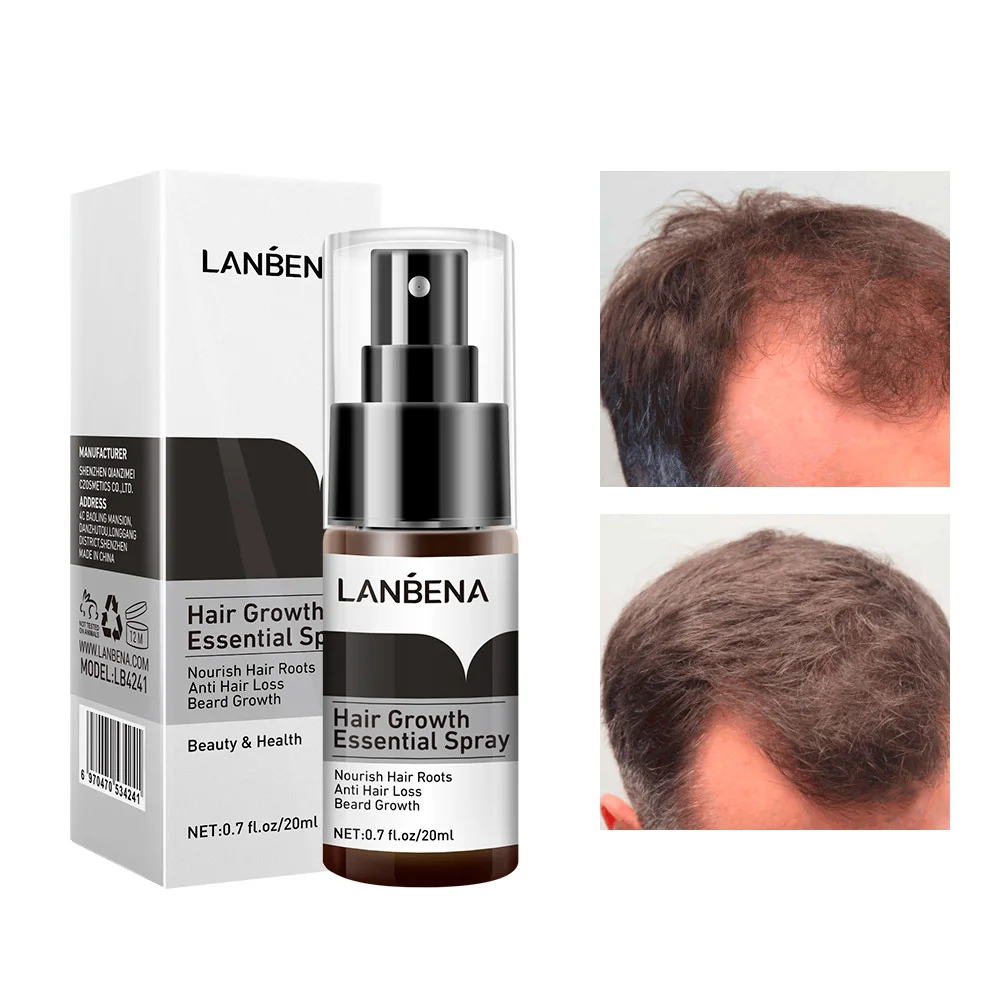 
LANBENA hair growing spray instant in hair loss treatment free shipping 