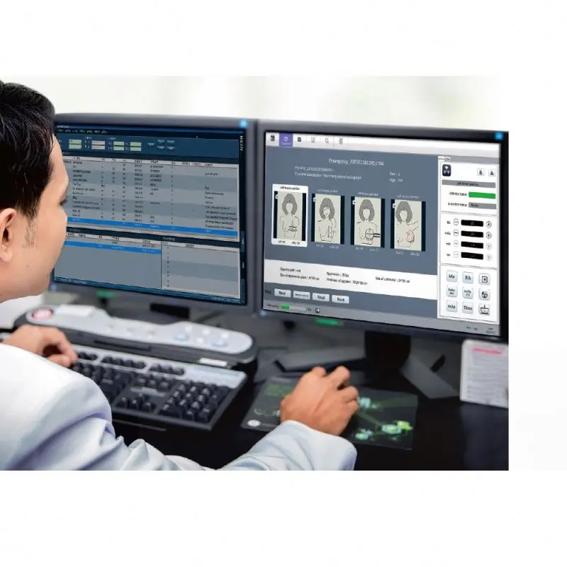 Mammography  digital mammography equipment price machine x-ray units