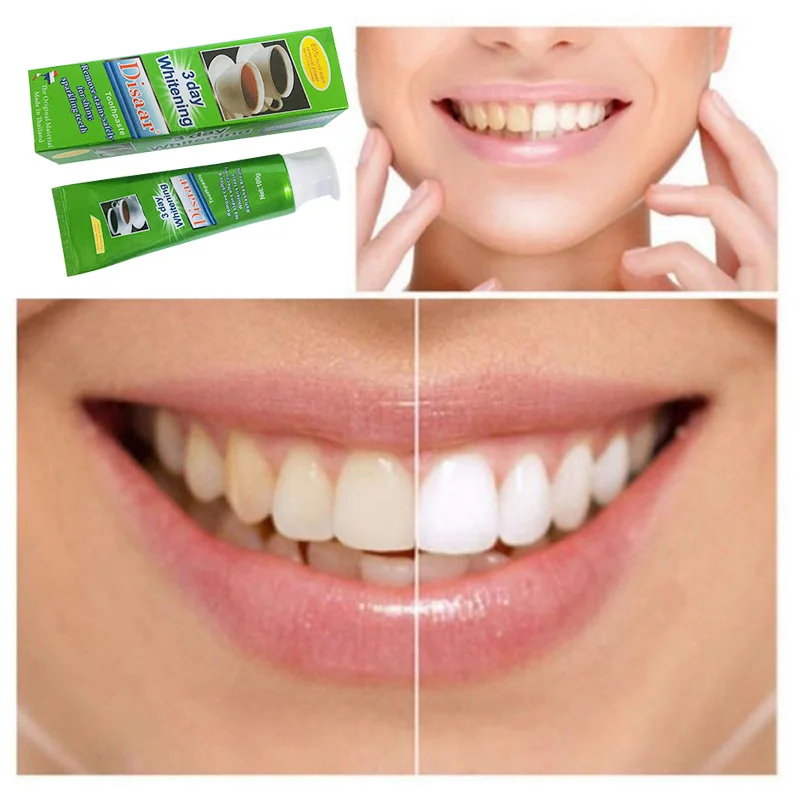 Teeth Whitening Toothpaste 3 Day Remove Tea Stains Coffee Stains Anti-cavity Toothpaste