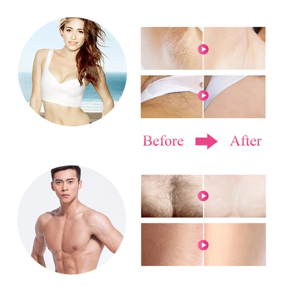 IPL Laser Permanent Hair Removal Home Handle Mini Portable Electric Epilator Hair Remover For Face and Body