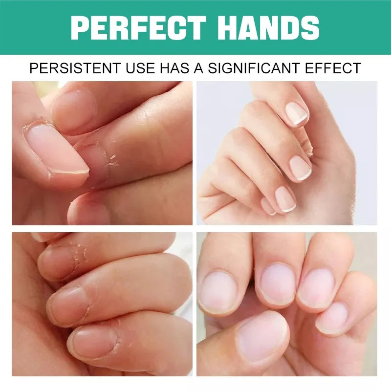 Private label nutrition oil revitalizer nail cuticle oil flower cuticle oil for nails