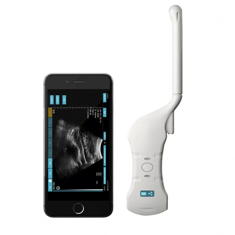Medical Imaging Equipment Portable wireless wifi ultrasound scanner transvaginal ultrasound probe wireless