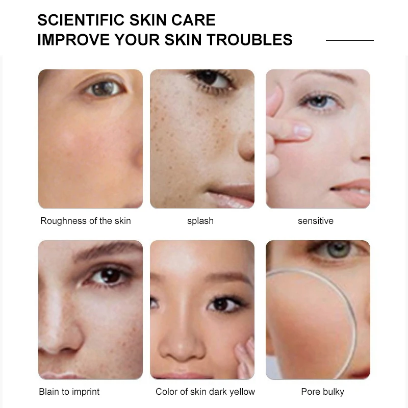 2023 Vertical Lumenis M22 IPL AOPT HR Laser Hair Removal machine photon facial skin rejuvenation equipment laser M22