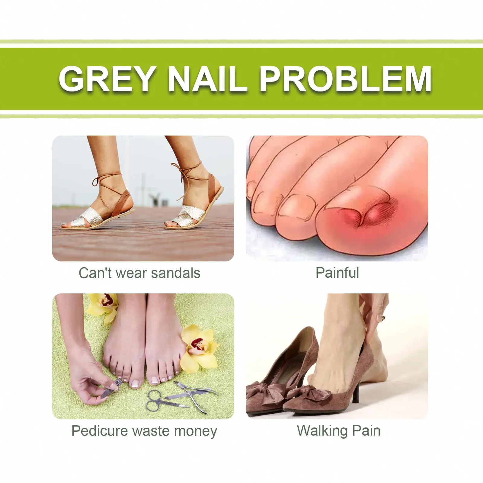 Costom Natural Organic Nail Care Paronychia Fungal Treatment Nourishing Soft Nail Repair Bad Thickening Fungal Treatment Gel 20g