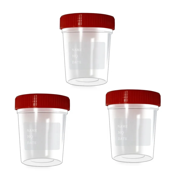 sterile hospital male Urine specimen cup urine sample containers urine collection cup 60ml