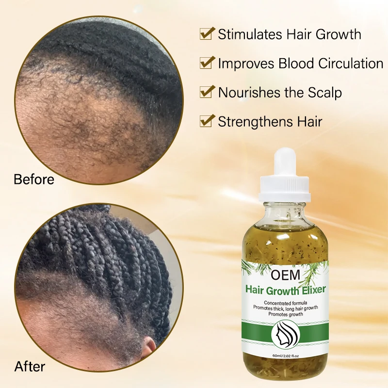 Customised Herbal Blend Rosemary Infusion Extreme Hair Growth Scalp Massage Oil Mint Castor Anti Alopecia Hair Strengthening Oil