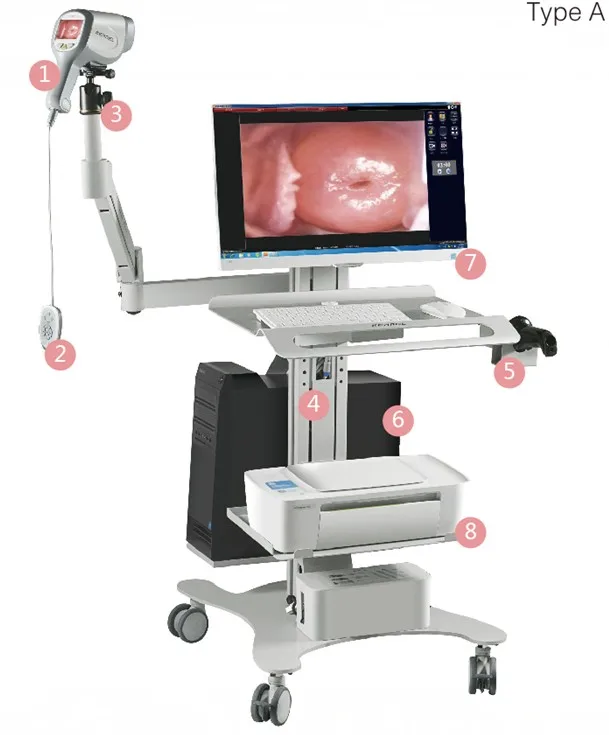 Medical CE Handheld Colposcope Portable Gynecology Colposcopy System Digital Electronic Gynecology Video Colposcope