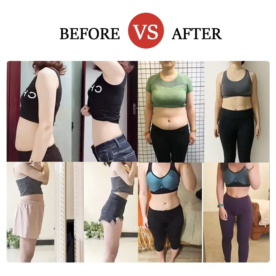 100% Natural Skin Tightening & Stretch Mark Treatment Anti Cellulite Massage Oil