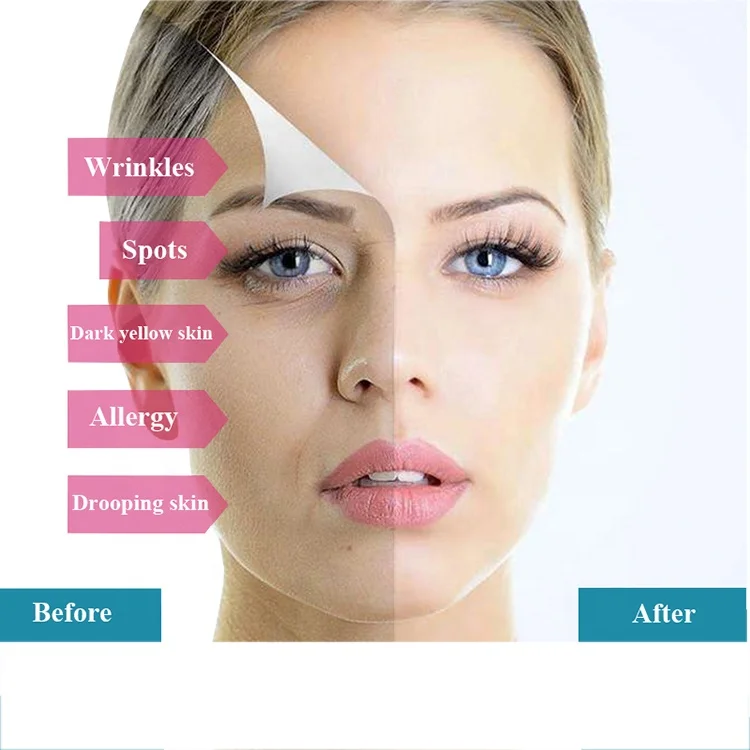 Private label Meso MTS 7pcs Whitening remove wrinkles repairing anti-aging B12 Niacinamide Hyaluronic acid facial serum kit