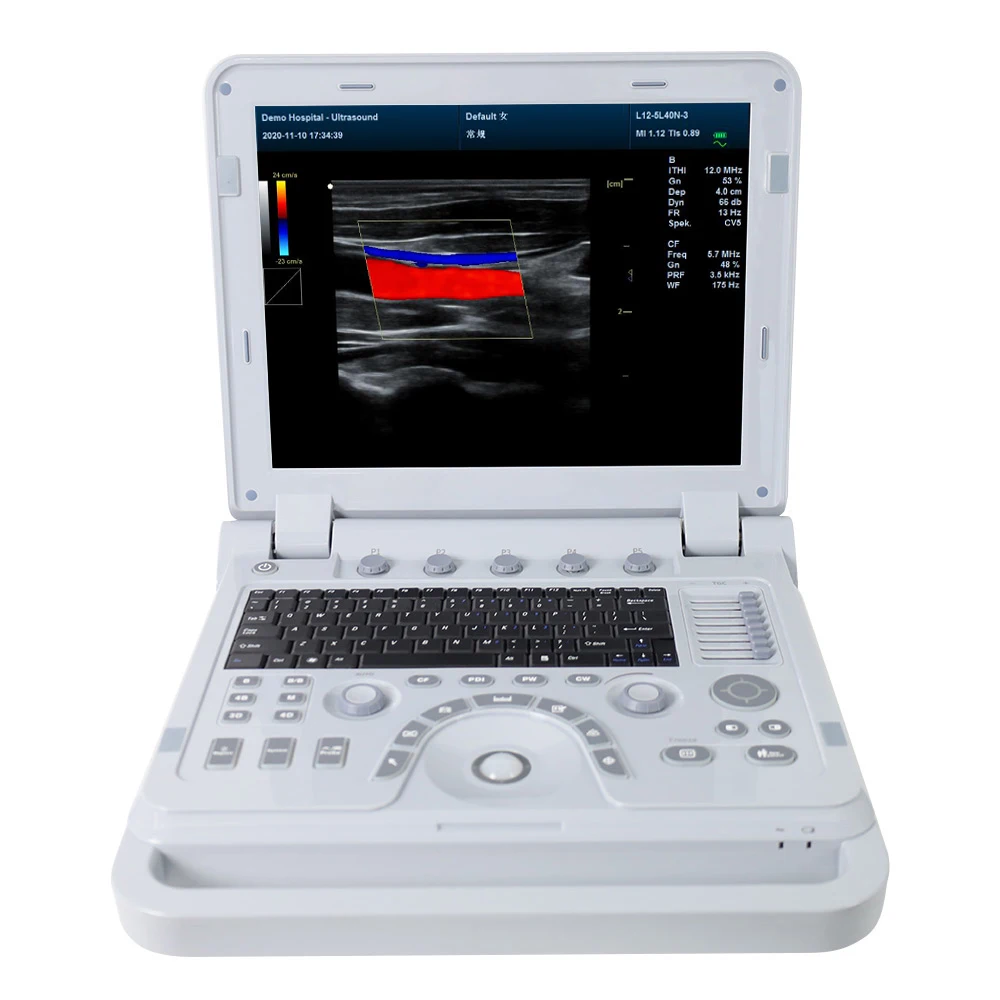 CONTEC CMS1700B 3d and 4d ultrasound scanner laptop ultrasound color doppler