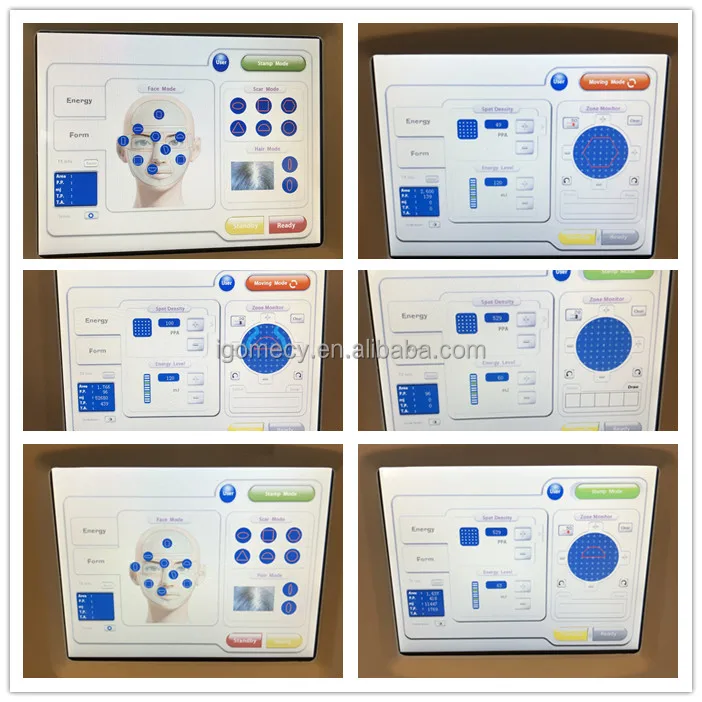  Er-Yag-laser-erbium-glass-fractional-laser/ 1550nm -erbium-glass-fiber-laser-stretch-mark-treatment  1550nm-fiber-erbium-glass-laser acne-treatment-machine 1550nm-erbium-glass-fiber-laser