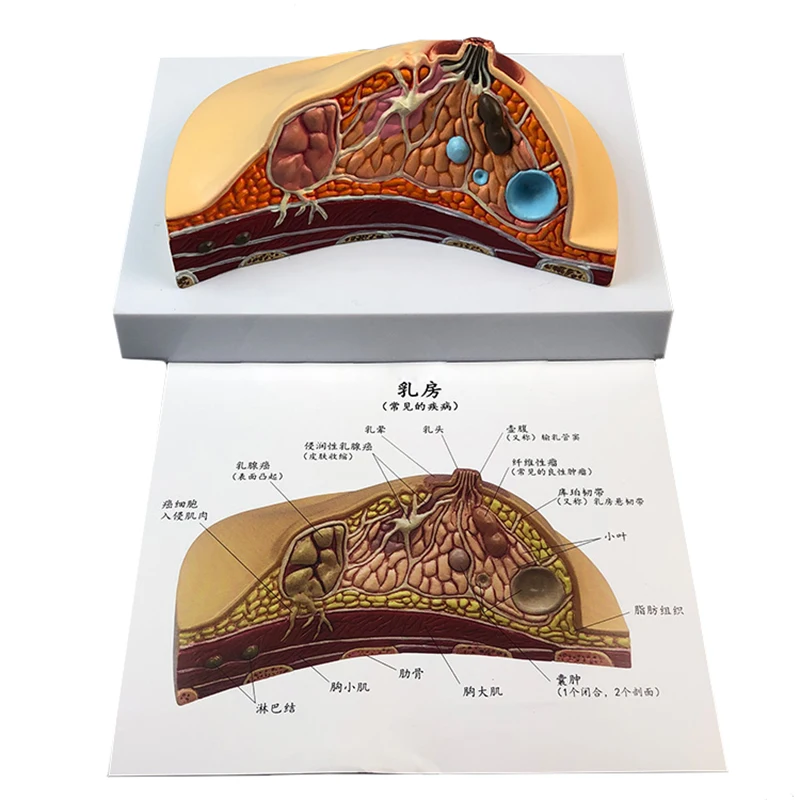 Medical Anatomy System Human Pathology Breast Model For Female Breast Healthy