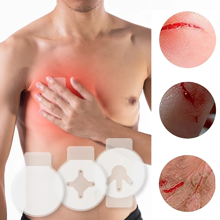 Wholesale Hydrogel Occlusive Trauma Medical Chest Seal Vented Rescue Emergency Chest Seal For Open Chest Injuries