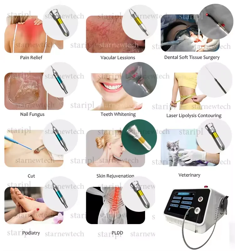 Newest densitometro hueso portatil ecografo mindray  2024 laser diode endolaser surgical ent diode laser  diode surgical