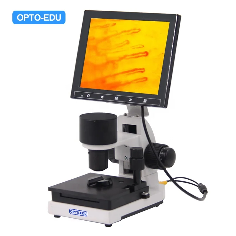 OPTO-EDU A33.0220 8' LCD Noninvasive Nail Microcirculation Checking Microscope