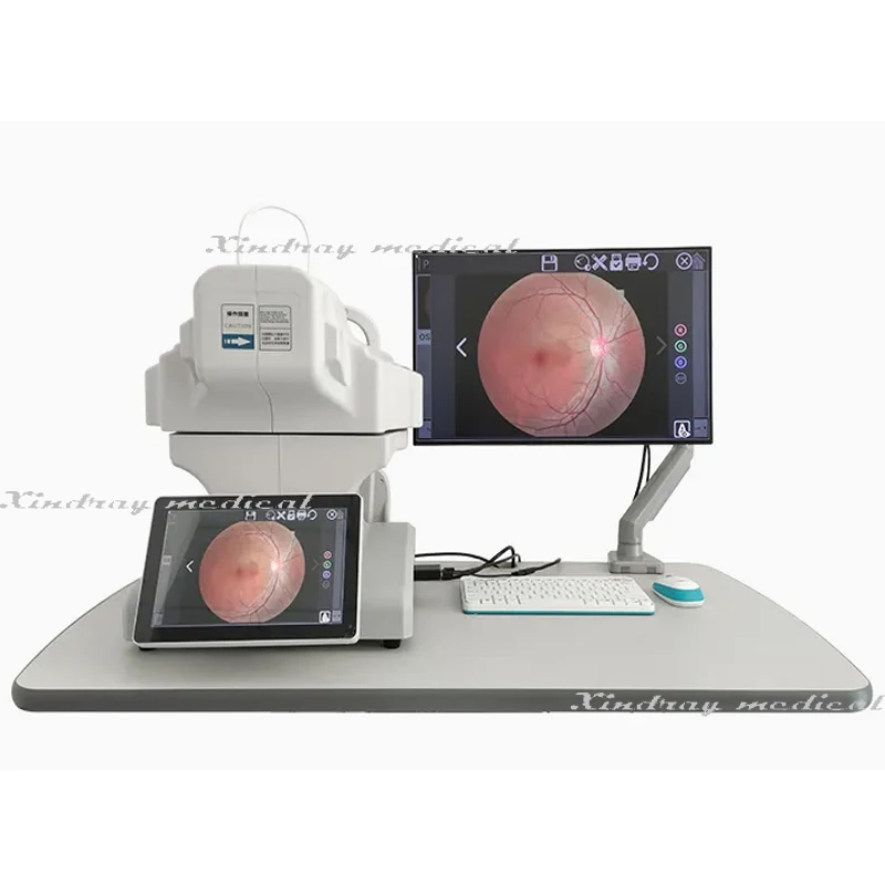 RC650b Ophthalmic Diagnosis Non Mydriatic Digital Retinal Fundus Camera with Ffa Function