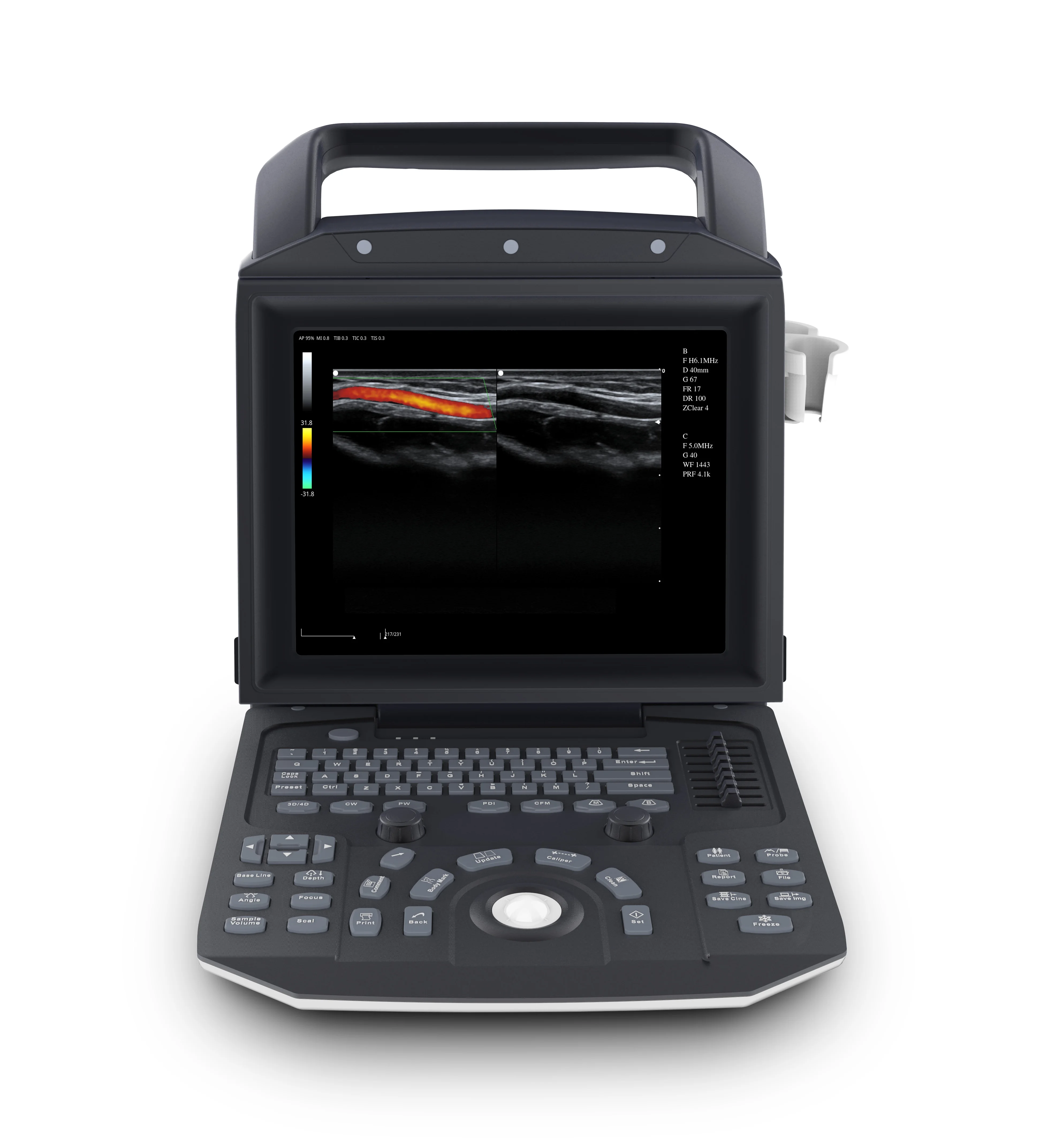 Medico Ecografo Portatil Ultrasonido Portable Color Doppler CW TDI Cardiac Ultrasound Machine Price