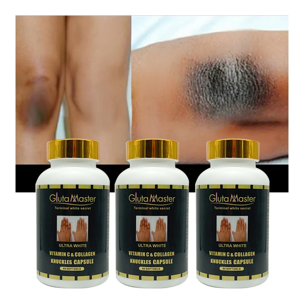 Средство для удаления пятен на коленях