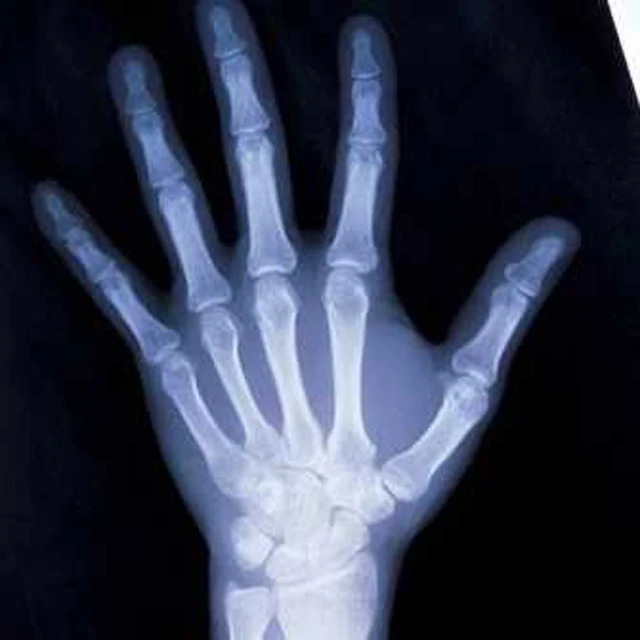 x ray film digitizer xray camera film