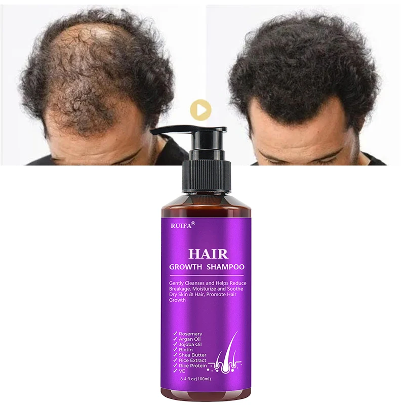 Private Label Anti Hair Loss Sulfate Free Organic Biotin Shampoo for Hair Growth