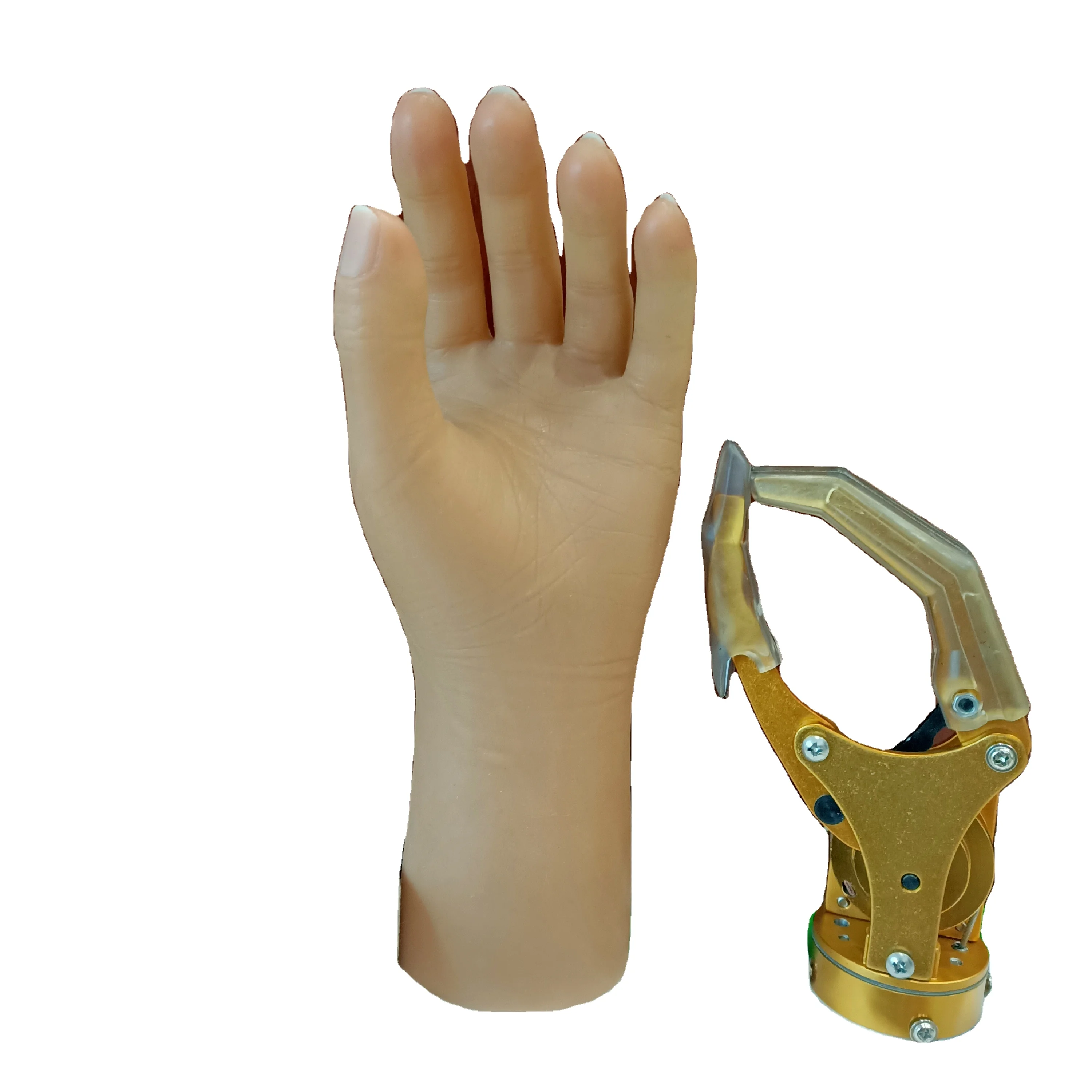 Medical Prosthetic Orthotic Implant Cable control mechanical Hand  ,  Silicon Artificial Hand