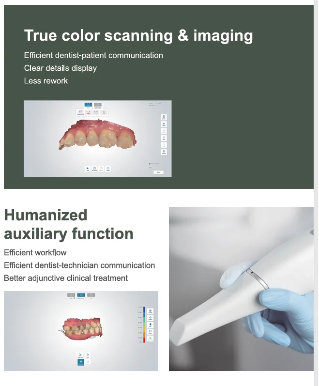 3D Digital Fast Scanning Process Intraoral Scanner Dentistry 3.0 Ture Color Anti-Fog Oral Scanner