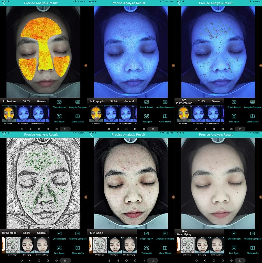 Au-M9 Skin Analysis Instrument 3D Skin Analyze Skin Problems Newest Technology Facial Analyzer