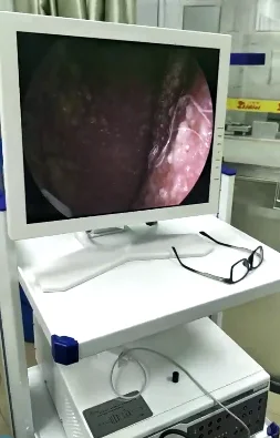 Complete Set Veterinary Endoscopy System