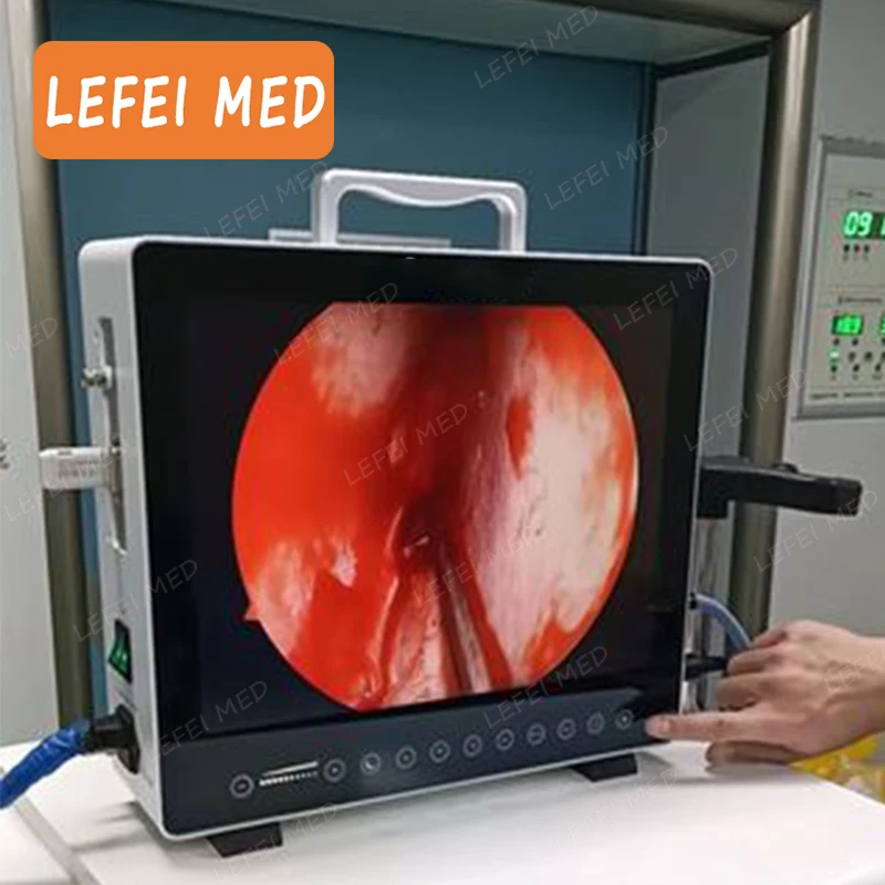 3 in 1 endoscope camera  Medical endoscope camera system gynecology camera urological endoscopy ent endoscope with light source