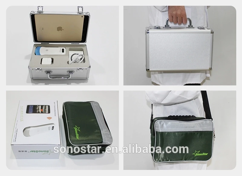 
Hot Selling 4D Portable Ultrasound Machine Price For Pregnancy Bady Monitor 