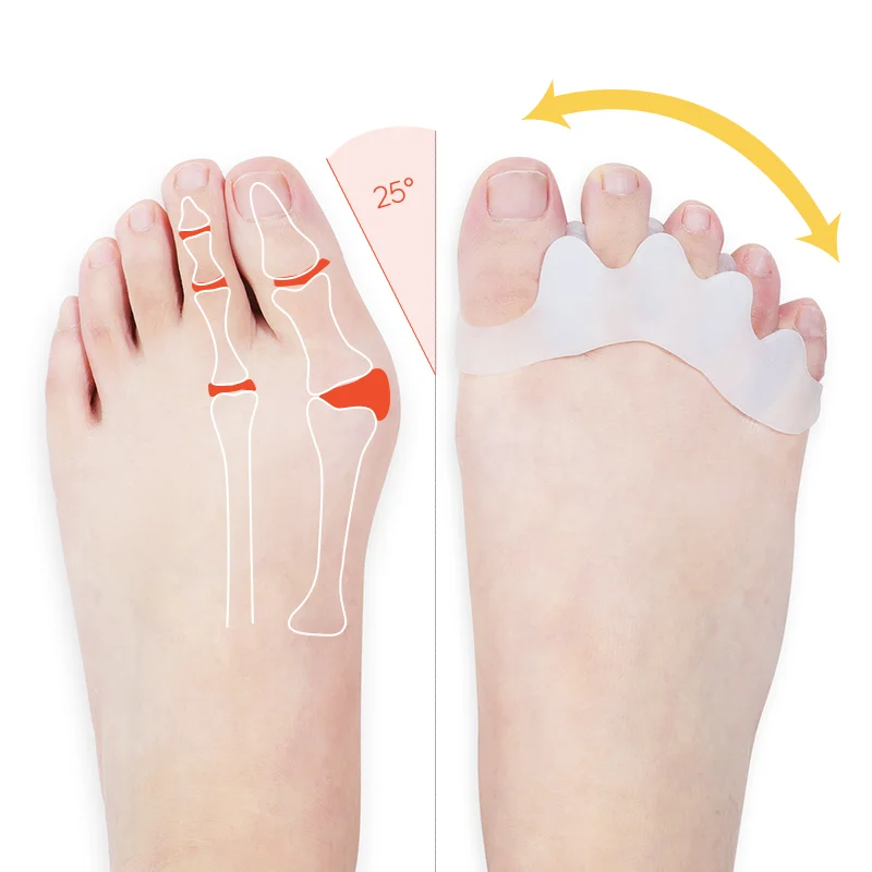 Joghn корректор пальца ноги силиконовый для большого стопы можно Thumb Valgus протектор предотвращая появление мозолей инструменты ногтей забота о ногах разделители пальцев