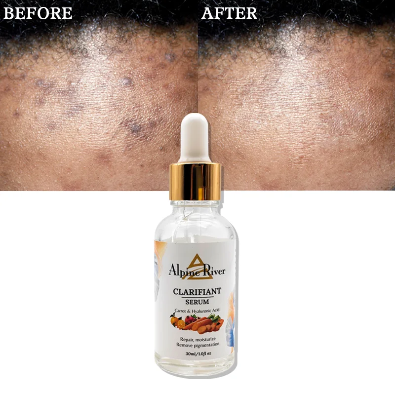 Oem Quality Beauty Skin Care Cosmetics Whitening Face Essence Hyaluronic Acid Anti-Aging Moisturizing Serum