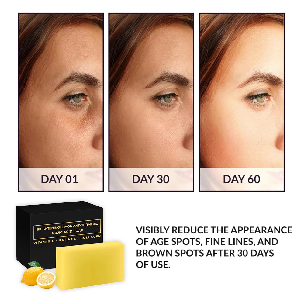 Wholesale Nature Organic Original Skin Whitening Limonic Kojic Acid Soap Private Label Lemon & Kojic Acid Soap