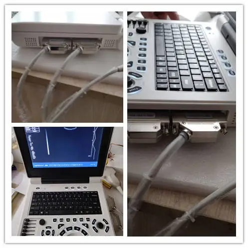 JM-806H Diagnostic Ultrasound System 2D ultrasound Imaging Ultrasonic Machine