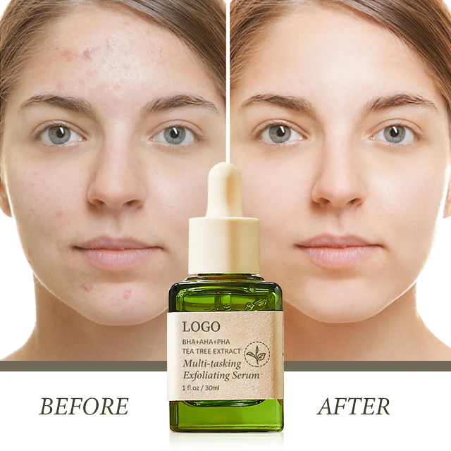 Wholesale 30 Ml Salicylic Acid Facial Serum Cleanse Anti-Acne Face Exfoliating Aha Bha Serum Private Label for Skin Care