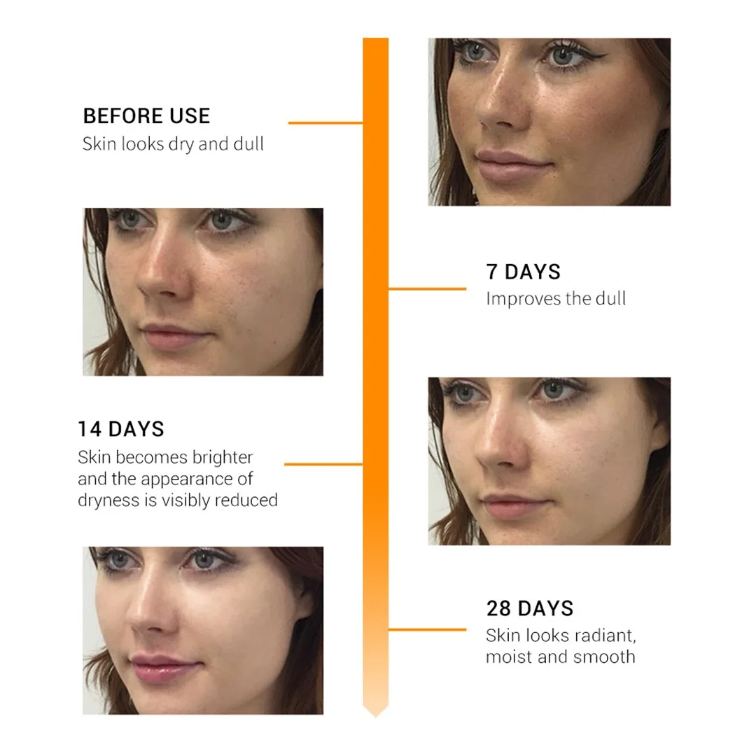 Private label Beauty salon Meso lifting Aqua Stem Cell Culture Ampoule using with meso white BB anti-aging Essence serum kit