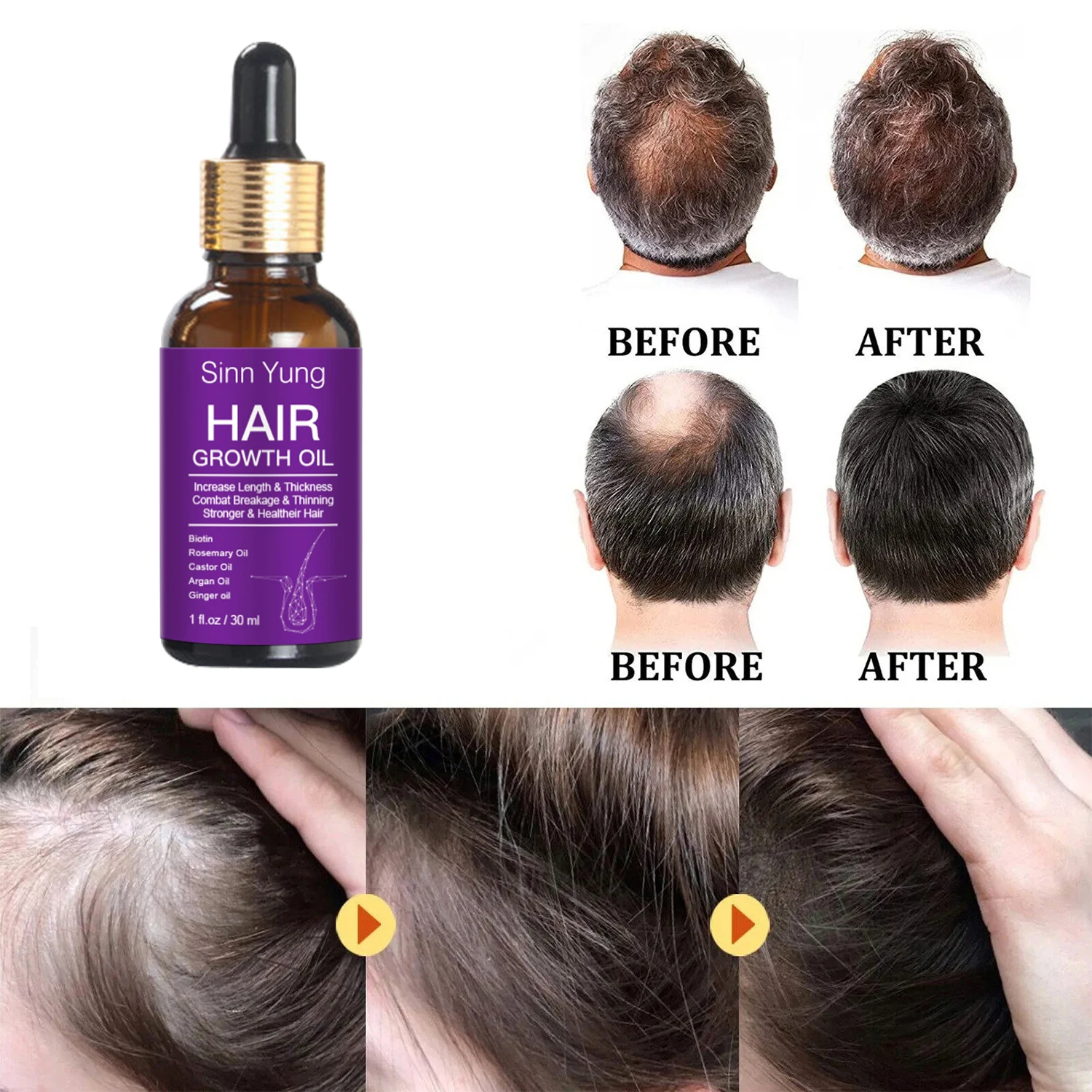 Private Label Indian Hair Regrowth Treatments Anti Hair Loss Organic Natural Castor Rosemary Serum Hair Growth Oil