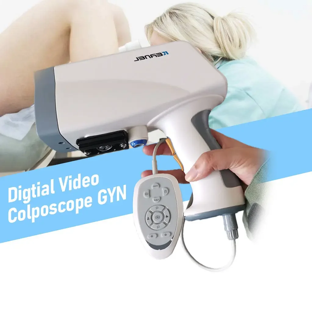 CE Approved KERNEL KN 2200 Portable Digital Video Colposcope for Gynecology Vagina Examination