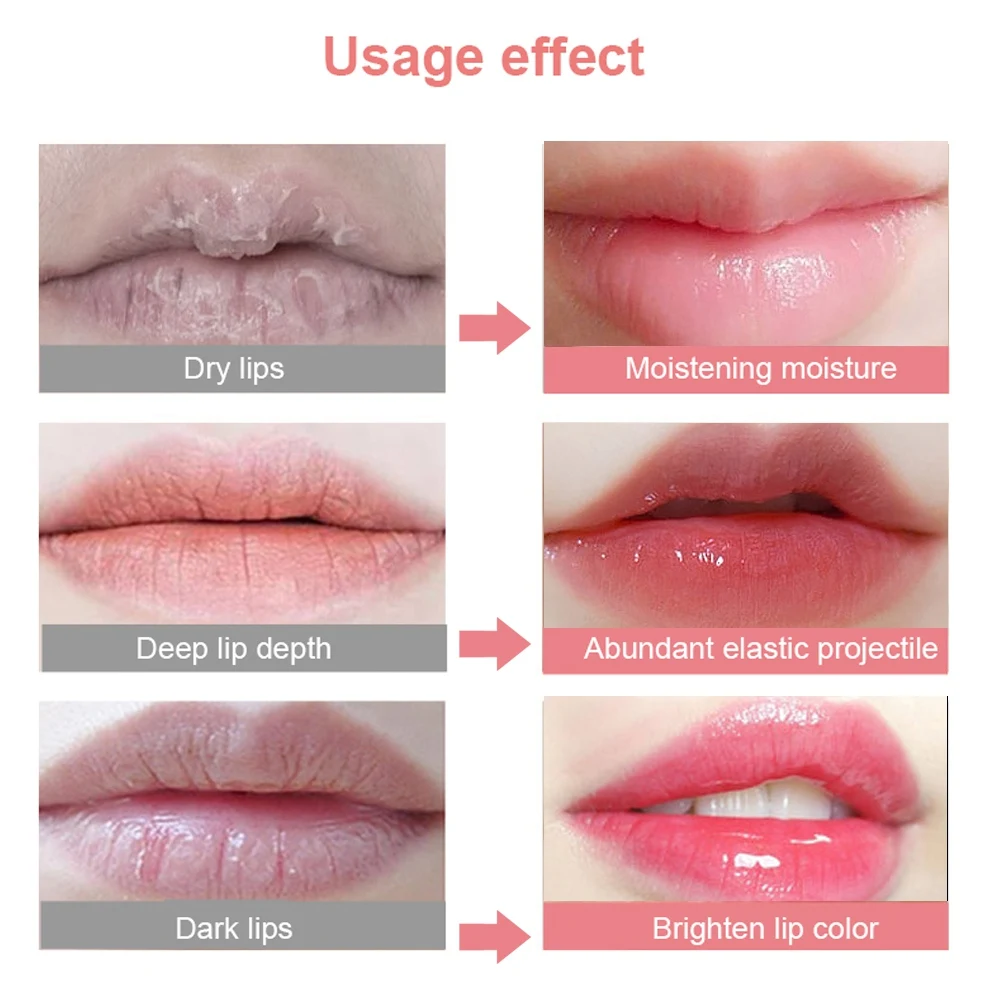 Custom Brand Collagen Lip Mask Hydrating Moisturizing Essence Gel Patch Lip Masks Lip Care Balsamos Labial Enhancer Pads Patches