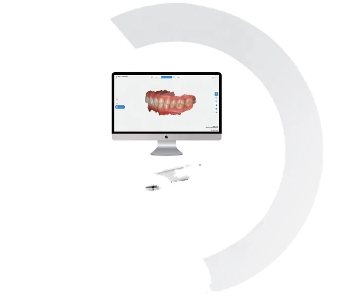 factory price oral scanner 3d dental intra oral scanner