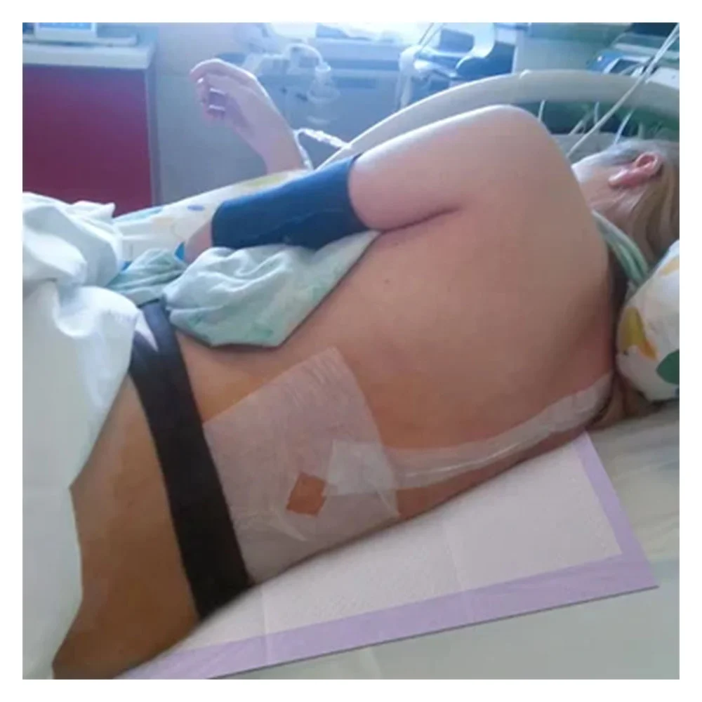 OEM Skin-friendly Breathable Adult Hypo Allergenic Medical Adult Incontinence Hospital Bed Pad 60x90 Disposable Underpad