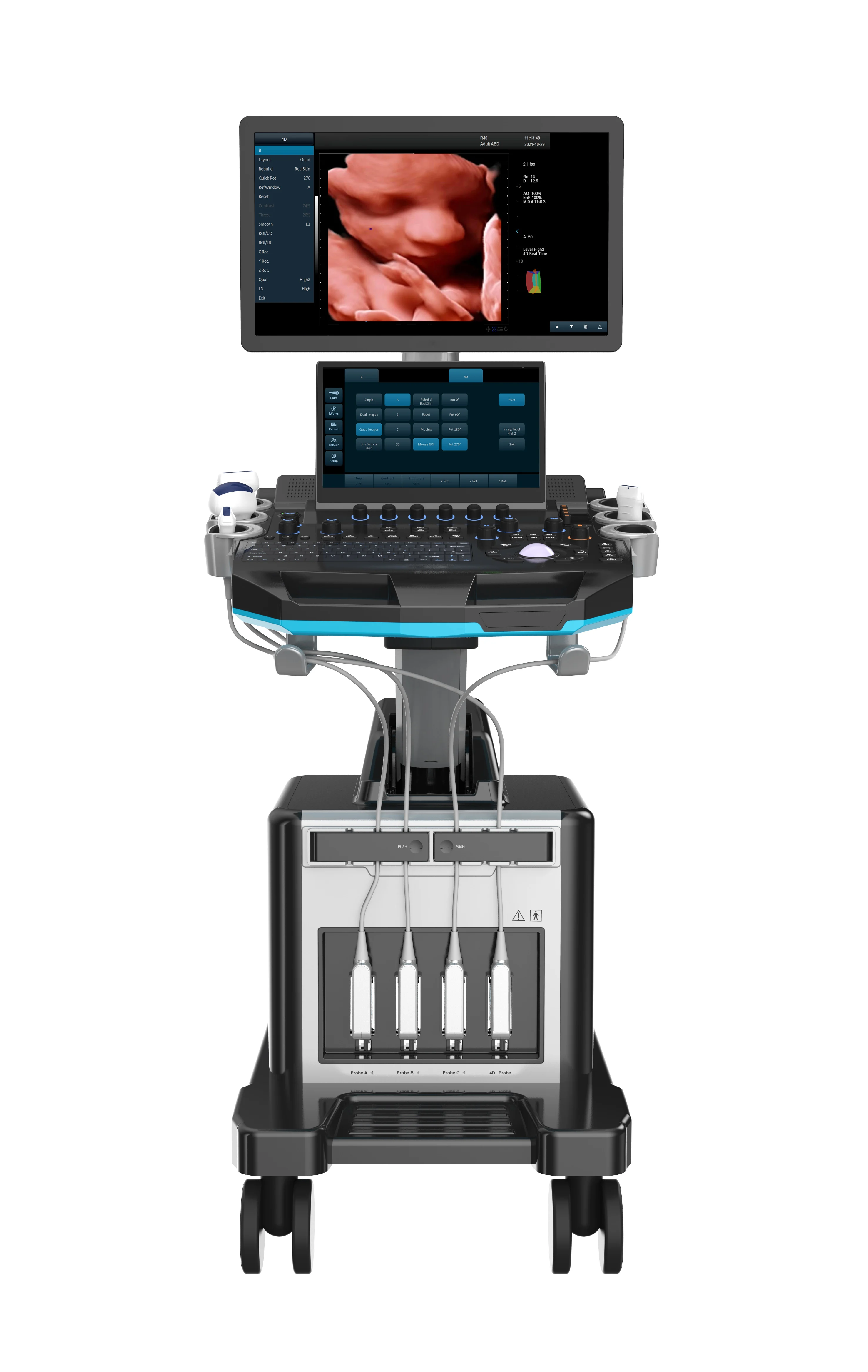 Medsinglong Black & White Medical Ultrasound machine  Diagnostic Trolley Ultrasound Machine