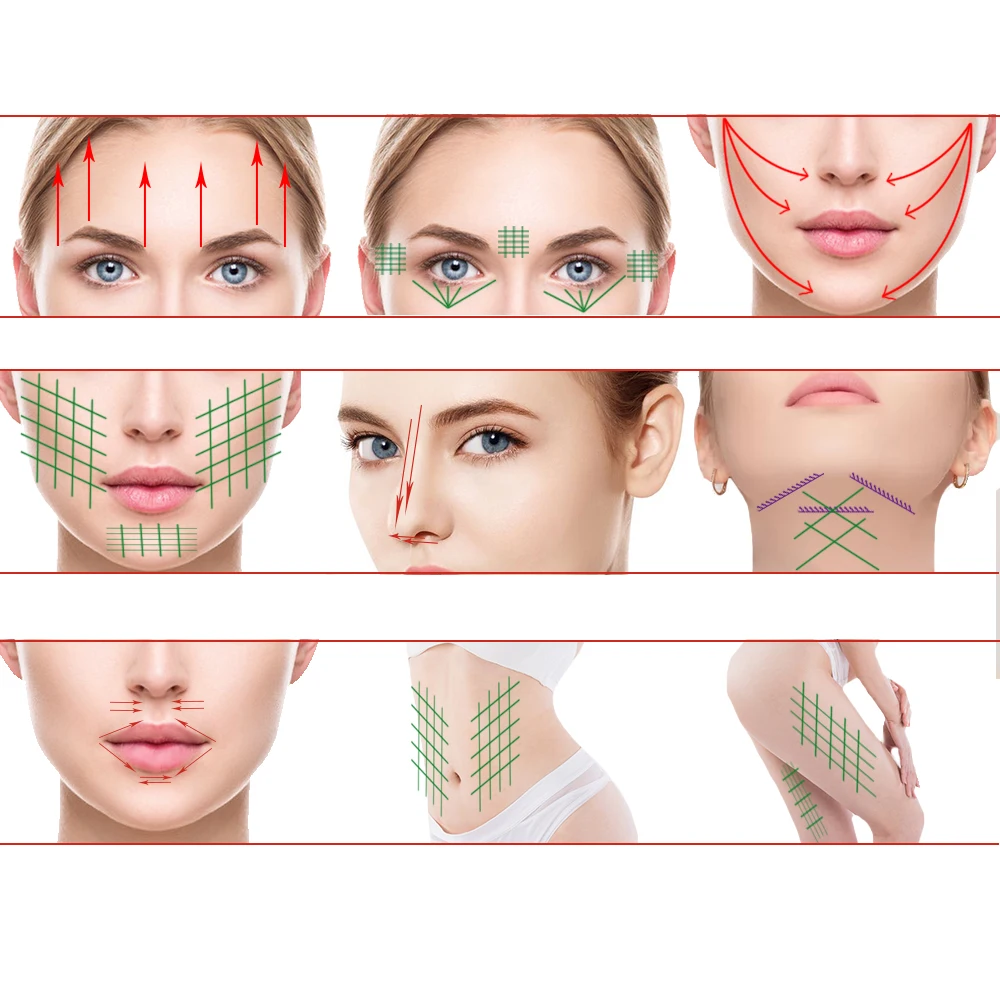 Wholesales Price 30G 38mm Beauty Salons Use Mono Thread Pdo For Mouth